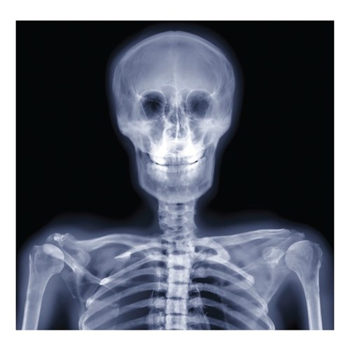 X-Ray Human Body Kit