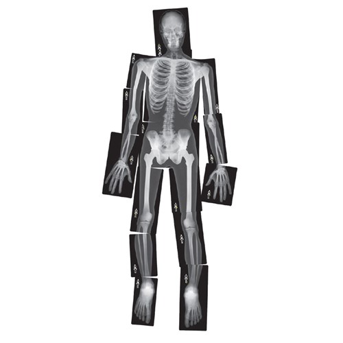 True to Life Human X-Rays - Pack of 18